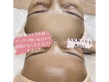 シファ(SHIFA)/産毛もしっかりキャッチ！