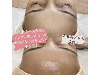 シファ(SHIFA)/産毛もしっかりキャッチ!