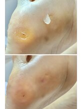 ラヴィ(La vie)/歩行時に違和感