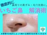 ★都度払い★鼻周りでお悩みの方へ～イチゴ鼻、黒ずみ改善、毛穴縮効果大
