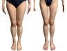 【浮腫み撃退!!美脚】ハイパーナイフ×キャビテーション×筋膜リリース¥7,500