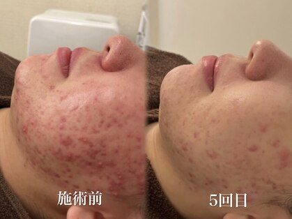 サロン ムスブ(salon MUSUBU)の写真
