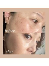 リヴィリア(Revilia)/