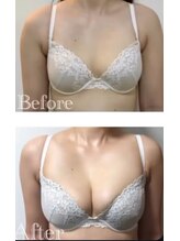 スマイルクルー(SmileClue)/ビフォーアフター症例