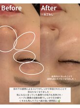 ニコ(nico)/毛穴の開き・血管も綺麗に