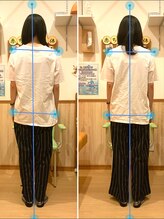 すぎうら整体院 浜松院/姿勢の変化