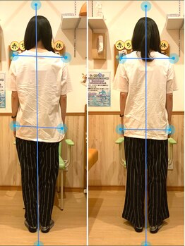 すぎうら整体院 浜松院/姿勢の変化