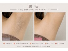 サマラボ 三軒茶屋(Sama Labo)の雰囲気（脱毛：メンズ脱毛も◎お子様の脱毛デビューにも♪）