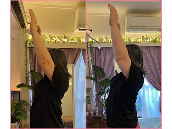 リセットモア(Reset More)/before after 1回の施術で