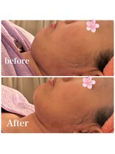 ルミナス(Luminous)/美肌＆小顔