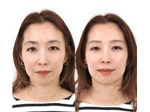 ルアナ(LUANA)/変えたのは眉毛の毛流れのみ♪