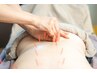 【ボディ鍼】腰痛に効果◎鍼の刺激で腰の辛さを緩和！¥4400