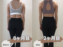 ラティコ(LATECO)/Before＆After