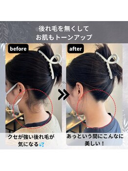 ヒダマリ 新屋敷店(Hidamari)/美肌脱毛でトーンアップ！