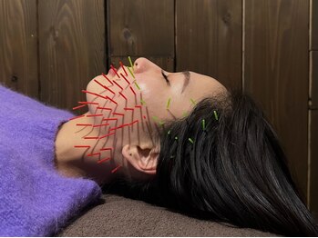 オアシス トウキョウ(Oasis Tokyo)の写真/皮膚・筋肉・細胞・神経へアプローチするサボテン美容鍼