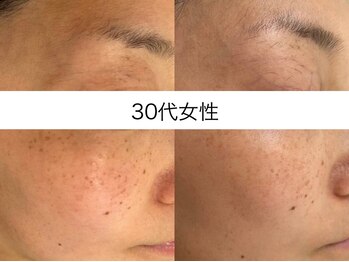 サクラ 本厚木駅前店(SAKURA)/本厚木シミケア/伊勢店シミケア