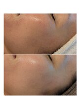 イロドリ(irodori)/毎日のこつこつお手入れ♪