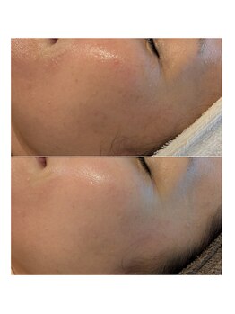 イロドリ(irodori)/毎日のこつこつお手入れ♪