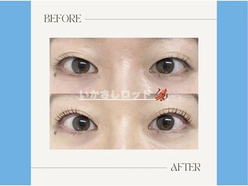 モストアイズ 下北沢(most eyes)/オーダーメイドまつ毛パーマ