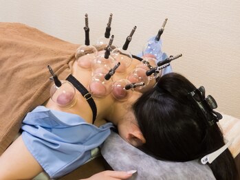 いなほ はりきゅう整骨院 東新宿/鍼灸(吸い玉併用)コース