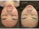 オヤム(oyam)の写真
