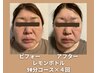 【小顔・二重あご】レモンボトル3cc+リンパ+LED+ヘッド90分¥16,000