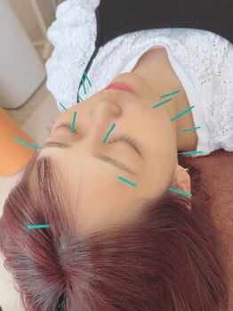 ヒーリングサロン アージュ(A-je)/★美顔鍼＋小顔矯正★