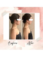 プレジール(Plaisir)/コルギ＆筋膜リリース＆EMS