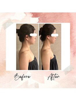 プレジール(Plaisir)/コルギ＆筋膜リリース＆EMS