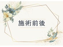 ヨサパーク ペチュニア 世田谷店(YOSA PARK Petunia)/