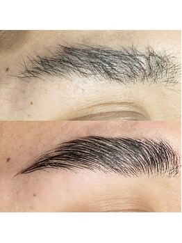 ダリアビューティー(Dahlia Beauty)/Before After画像