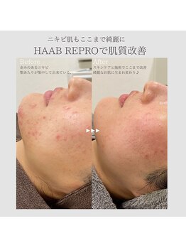 ビースタジオブランジュ(B STUDIO blange)/HAAB REPRO◇ハーブピーリング