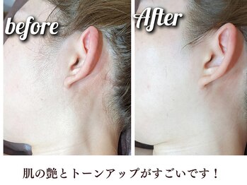 シエル(Siele)/お顔のお肌がツルツルに♪