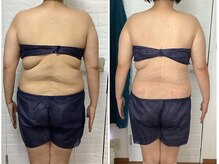 ビューティフルムーン(Beautiful Moon)/背中のハミ肉お任せ下さい♪