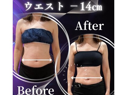 ラフィールの写真