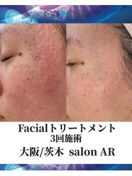 メンズサロンアール(AR)/プロセルセラピーズ