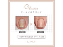 ネイルサロン フェリーシュ(Feliish)の雰囲気（Foot巻き爪緩和ケア★痛みや不快感を緩和！）