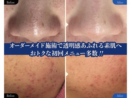 サバーイ サバーイ(SABAHI SABAHI)の写真