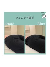 ザラハビューティー(ZARAHA Beauty)/フェムケア