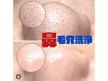 ディエール(Diailes)/毛穴洗浄