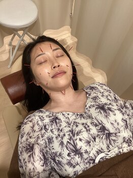 えんじゅく整骨院/美容鍼