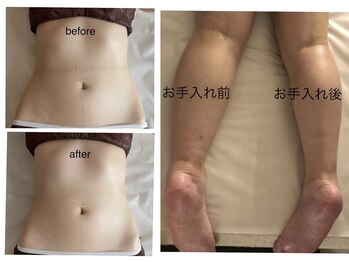 エステアンドネイルサロン ぶらんぶりえ