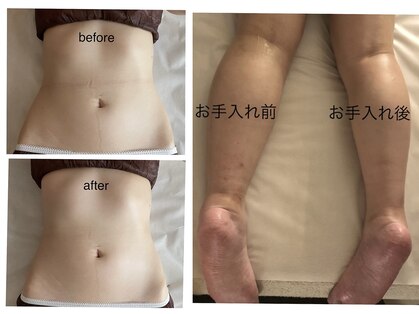 エステアンドネイルサロン ぶらんぶりえの写真