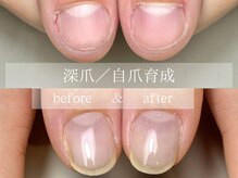 ル リアン 北浦和(le lien)/深爪育成(6ヶ月／8回)