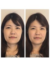 ハリ ヴァカンス(Hari Vacances)/ビフォーアフター