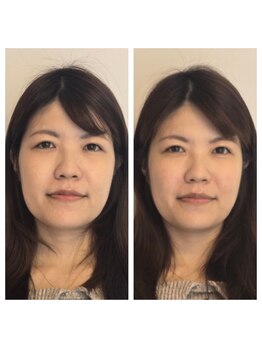 ハリ ヴァカンス(Hari Vacances)/ビフォーアフター