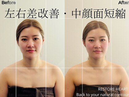 リストアハート(Restore Heart)の写真