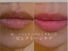 NEW【唇・バストトップをピンクに】話題のピンクトーンケア体験★1部位￥5000