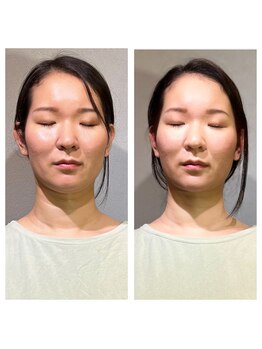 キワミ(KIWAMI)/＃首専門整体＃恵比寿＃頸椎矯正