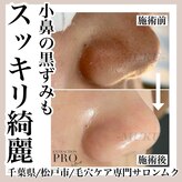 ムク(MUKU)